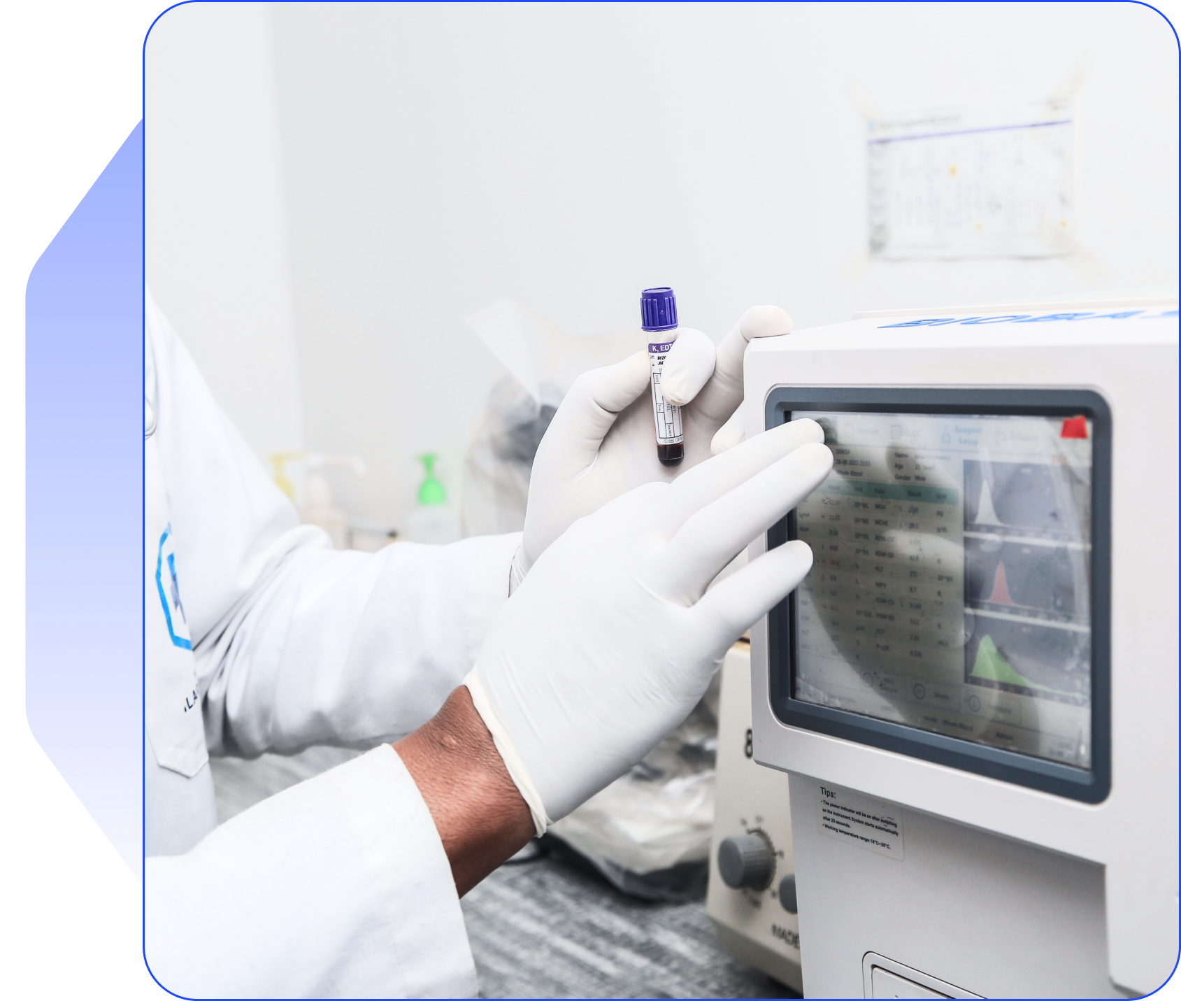 Pracitioner operating a haemogram